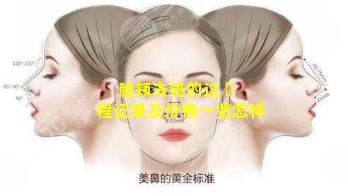 脸颊去斑的过 ☘ 程记录及价格一览怎样